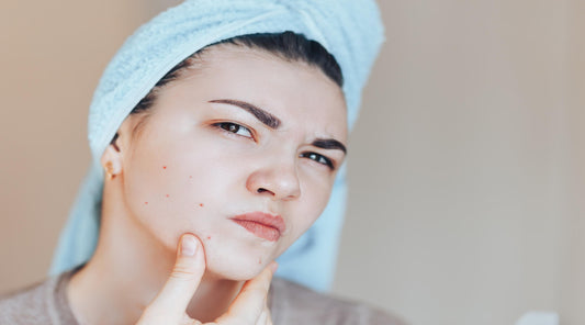 Sunscreen and Acne: Separating Fact from Fiction