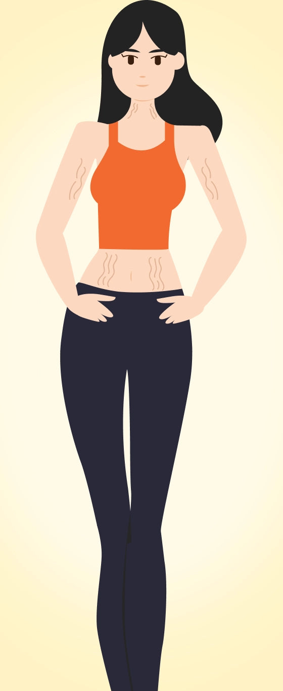 Body areas