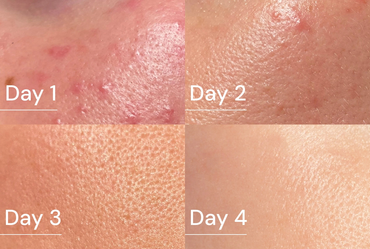 Toner Skin.webp__PID:68e6a251-16c4-4089-8383-72bce88ab9d3