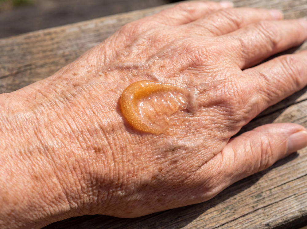 It Feeds Your Skin The Oil It Stopped Making