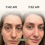 Sky & Sol Wake-Up Eye Patches